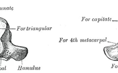  La greffe d’hémi-hamatum : Qu’est ce que c’est ?